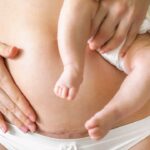 RENCARA C-Parts estão aumentando para aumentar o risco da infância da Lelemia, aprenda a encontrar