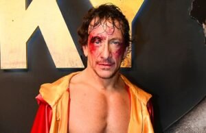 A mensagem do níquel Vazzz quando ele voltou ao teatro após a lesão: “Sinto -me abençoado com todos os aplausos”