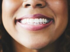 Caratina removida dos dentes de reparo de lã de ovelha em avanço