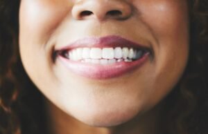 Caratina removida dos dentes de reparo de lã de ovelha em avanço