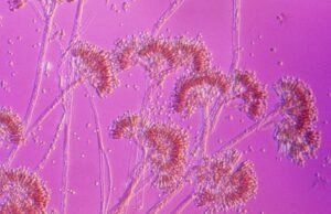 Você pode realmente não ser um Gicker da penicilina. Aqui está como descobrir se você está ou não.