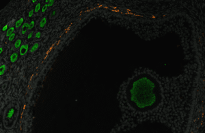 Finalmente, temos uma idéia de como um suprimento de ovos ao longo da vida está se desenvolvendo em primatas