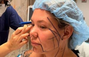 Calin Lori Double Double Chin Cirurgia Preparação: ‘Fairwell Tour’