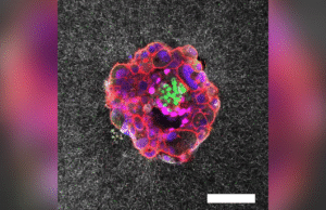 Vídeo incrível e de primeiro tipo mostra implantes de feto humano em tempo real
