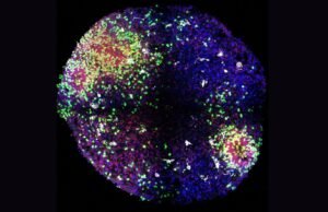 ‘Minibanos’ manifesta os segredos de como as células do cérebro são formadas no útero