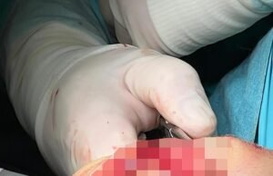 A estrela do Tottenham, Dein Kulcevsky, fã de porcos da cirurgia do joelho da cirurgia do joelho