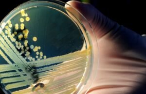 O que é Mali-Bot, os cuidados de saúde mental argentina que ajuda a ver as bactérias