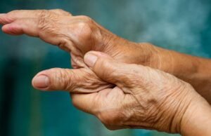 Eles vêem o primeiro sinal da artrite reumatóide antes que os sintomas apareçam