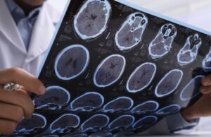 Os processos proteicos ligados ao cérebro podem ajudar a prevenir a Alzheimer, de acordo com a pesquisa