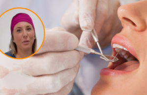 As 6 coisas que os dentes também são quando você viu sua boca: “Sabemos se você é esquerda ou direita”