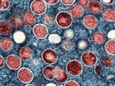 2 2 possíveis casos de irmãos confirmados em La County