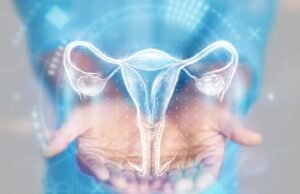 Endometriose e cistos policísticos: por que são imaturos e como identificá-los