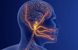 Neuralgia: um tipo de dor nos nervos, dependendo da área do crânio