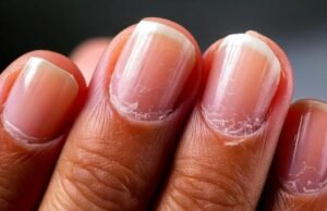 A melhor técnica para fixar as unhas e evitar que quebrem