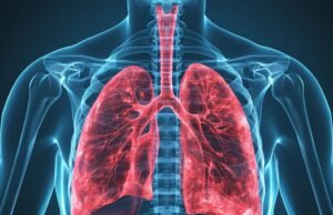Cebola e alho naturais: como preparar remédios caseiros para aliviar a tosse