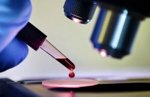 Eles identificam biomarcadores no sangue que podem detectar o Parkinson antes dos primeiros sintomas