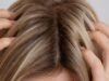 Causas da coceira no couro cabeludo além da caspa: do hipotireoidismo ao estresse