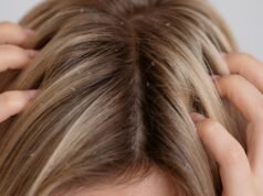 Causas da coceira no couro cabeludo além da caspa: do hipotireoidismo ao estresse