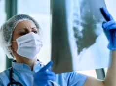 A tuberculose aumentou 8,3% em Espanha: Ceuta, Catalunha, País Basco e Galiza lideraram o aumento de casos.