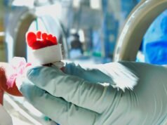 Outra criança morreu enquanto aguardava autorização da EPS News: o bebê Isaías David, que sofria de doença cardíaca, morreu em Cartagena após vários atrasos em uma grande cirurgia.