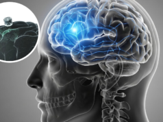 Imagens cerebrais e depressão: detalhes do primeiro teste em humanos