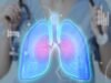 Nova tecnologia torna o diagnóstico e tratamento do câncer de pulmão mais rápido e seguro