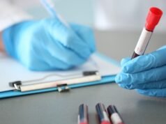 A maioria das pessoas fará um exame de sangue para detectar Alzheimer, diz estudo