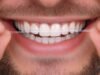 A relação desconhecida entre o uso do fio dental e a prevenção de doenças cardíacas