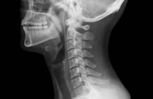 Qual tecnologia é usada para detectar objetos estranhos na garganta e em outras partes do corpo humano?