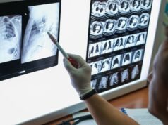 Câncer de pulmão: causas, sintomas e tratamento