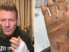 Músico Javier Malosetti sofre acidente que o impede de tocar e fala sobre recuperação: “Dia triste”