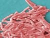 19 casos de infecção por Legionella ligados aos hospitais da área da baía de Kaiser