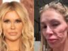 Tumor benigno, 3 anos sem doença e pesquisa incansável: a história de Brandi Glanville