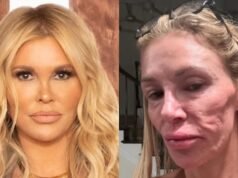 Tumor benigno, 3 anos sem doença e pesquisa incansável: a história de Brandi Glanville
