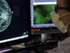 O que a COVID está ensinando aos médicos sobre a conexão entre o vírus e o câncer