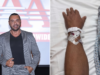 Latin Lover entrou na sala de cirurgia e pediu aos fãs que orassem por ele