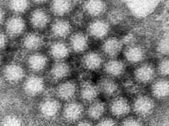 Um surto de Norovírus em um navio de cruzeiro da Califórnia deixou mais de 100 passageiros doentes